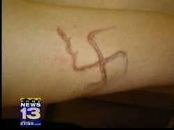 swastika symbol burned into a Navajo man's arm